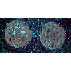 Ein gutes Zeichen: Knochenbildende Zellen (violett) haben ein Hydrogel, das wie Knochen strukturiert wurde, bereits besiedelt und Kollagen (hellblau) produziert.  Quelle: Xiao-Shua Qin  Copyright: ETH Zürich