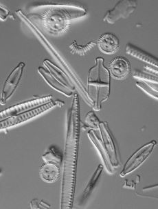 Lichtmikroskopische Aufnahme von Glasschalen verschiedener, einzelliger Kieselalgen  Konrad Schultz  Universität Rostock