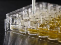 In einem Mikrobiom-Modell für akneanfällige Haut enthält das Kulturmedium künstliches Hautfett und -schuppen  Evonik Industries AG