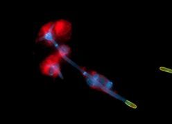 Durch die Bildung von langen fadenähnlichen Zellen, den Hyphen, bricht der Hefepilz Candida albicans (blau) aus menschlichen Immunzellen (rot) aus. Der Teil der Hyphe, der die Immunzellen bereits verlassen hat, ist gelb eingefärbt.  Copyright: © Erik Böhm, Leibniz-HKI