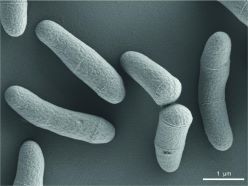 Corynebacterium glutamicum im Raster-Elektronenmikroskop. Die Stäbchen sind nicht ganz gleichmäßig und damit wie Keulen (griechisch coryne) geformt. Die „schnappende“ Zellteilung führt zu aufgeklappten V-förmigen Strukturen .  Urska Repnik, CAU Kiel, CC BY 4.0
